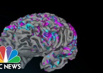 Artificial intelligence study decodes brain activity into diaglogue