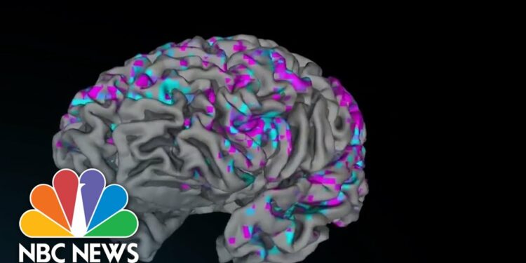 Artificial intelligence study decodes brain activity into diaglogue